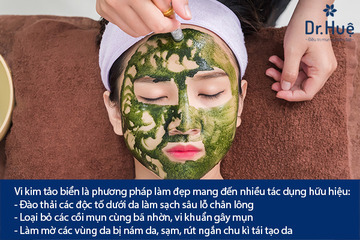 Vi Kim Tảo Biển Có Trị Mụn Được Không