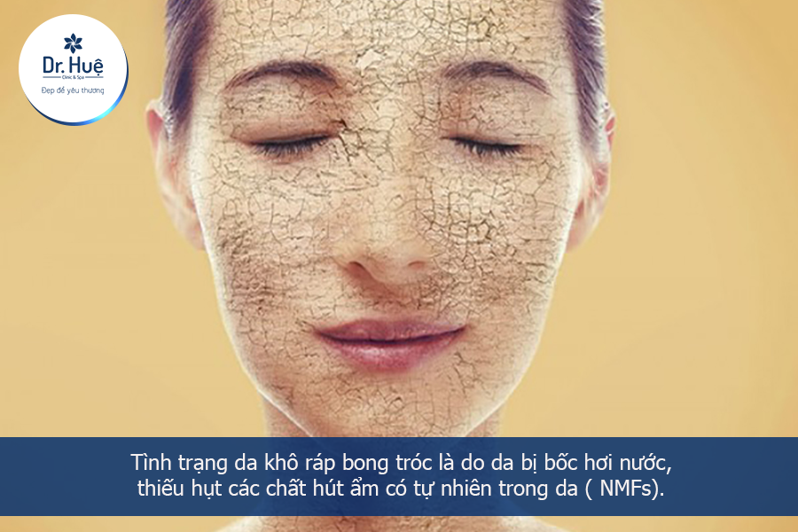 Nguyên nhân da bị khô bong tróc 