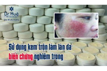 Vì sao sử dụng kem trộn làm làn da biến chứng nghiêm trọng