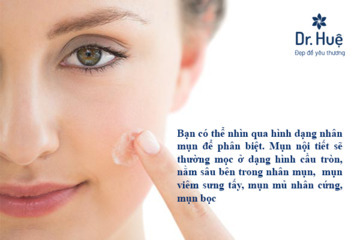 Vì sao uống phụ huyết khang bị nổi mụn?