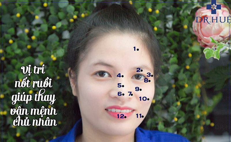 Vị trí nốt ruồi giúp thay vận mệnh chủ nhân