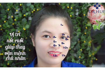 Vị trí nốt ruồi giúp thay vận mệnh chủ nhân